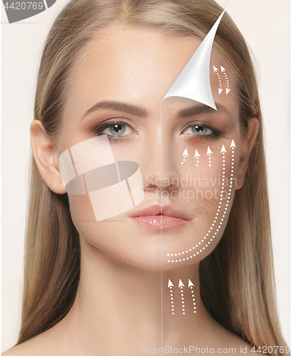 Image of The young female face. Antiaging and thread lifting concept