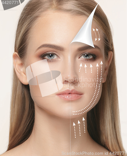 Image of The young female face. Antiaging and thread lifting concept