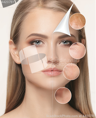 Image of portrait of beautiful woman with problem and clean skin, aging and youth concept, beauty treatment