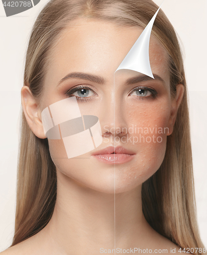 Image of Woman before and after treatment