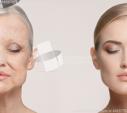 Image of Comparison. Portrait of beautiful woman with problem and clean skin, aging and youth concept, beauty treatment