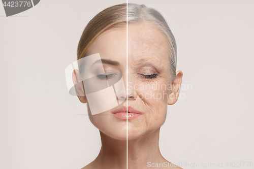 Image of Comparison. Portrait of beautiful woman with problem and clean skin, aging and youth concept, beauty treatment