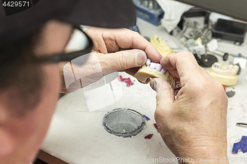 Image of Dental Technician Working On 3D Printed Mold For Tooth Implants