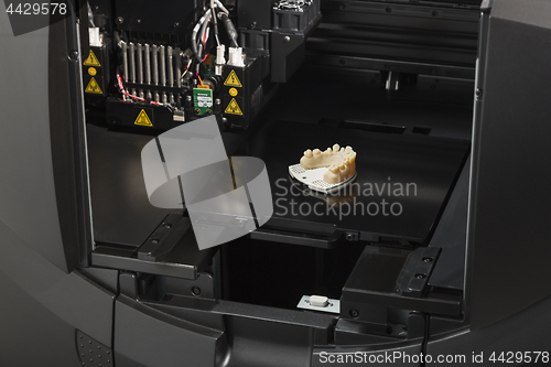 Image of 3D Printer With Finished 3D Printed Dental Implant Bridge