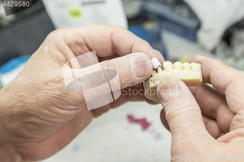 Image of Dental Technician Working On 3D Printed Mold For Tooth Implants