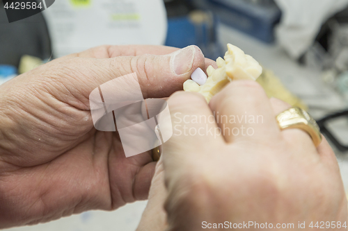 Image of Dental Technician Working On 3D Printed Mold For Tooth Implants