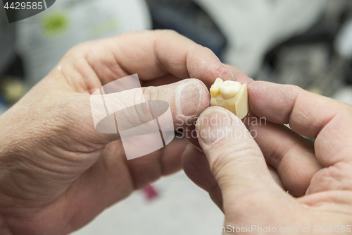 Image of Dental Technician Working On 3D Printed Mold For Tooth Implants