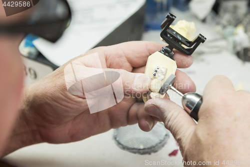 Image of Dental Technician Working On 3D Printed Mold For Tooth Implants