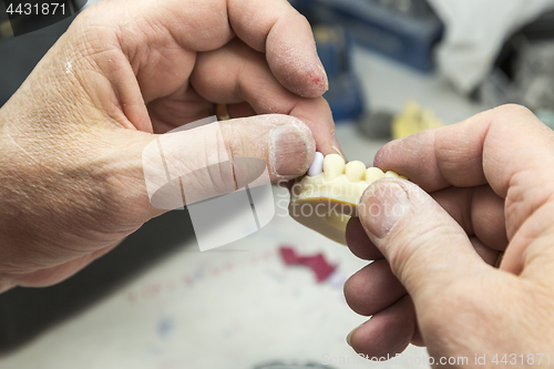 Image of Dental Technician Working On 3D Printed Mold For Tooth Implants