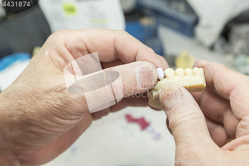 Image of Dental Technician Working On 3D Printed Mold For Tooth Implants