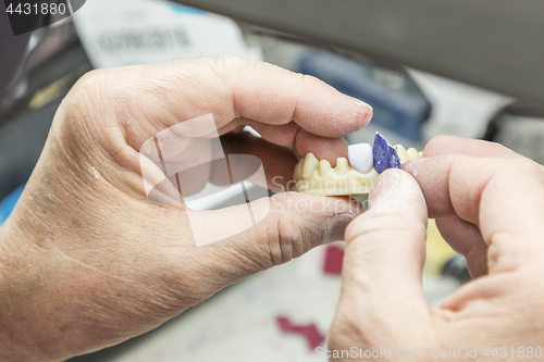 Image of Dental Technician Working On 3D Printed Mold For Tooth Implants