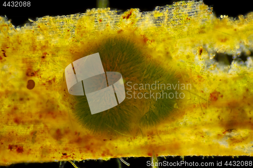 Image of Spherical colony of cyanobacteria (Gleotrichia, blue-green algae