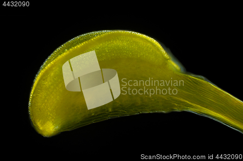 Image of Microscopic view of Common buttercup (Ranunculus acris) flower s