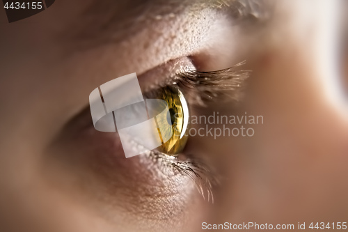 Image of honey colored eye iris