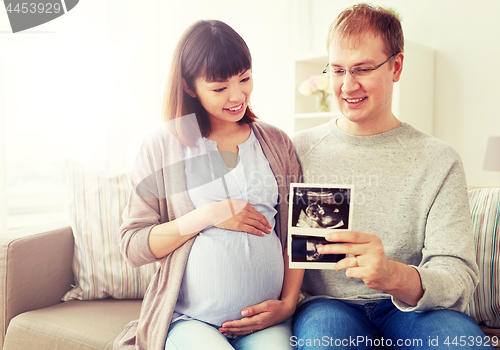 Image of happy couple with ultrasound images at home