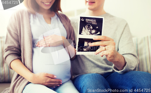 Image of close up of couple with baby ultrasound images