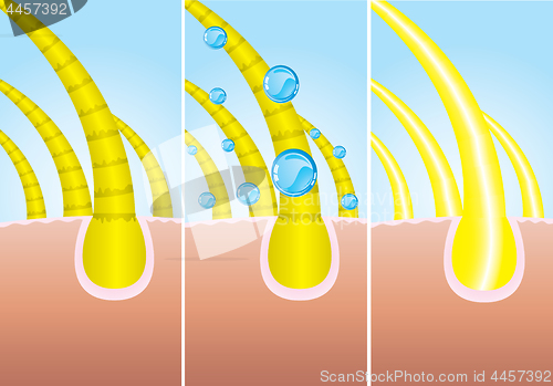 Image of Illustration of three phase of hair cure