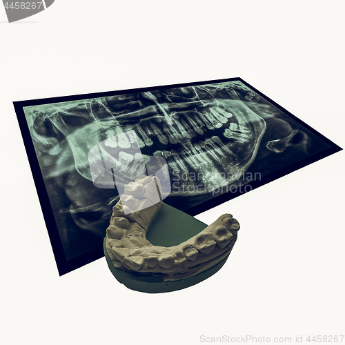 Image of Vintage looking Xray of teeth with positive teeth cast