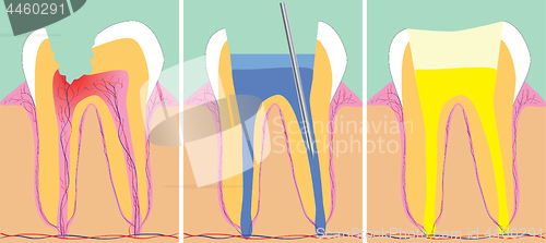 Image of Three phase of dentistry