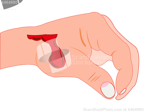 Image of Cut on hand of the person and blood current from is reeked