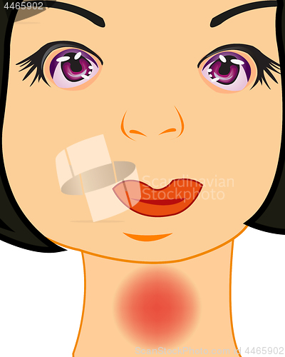 Image of Vector illustration of the girl with pain in throat