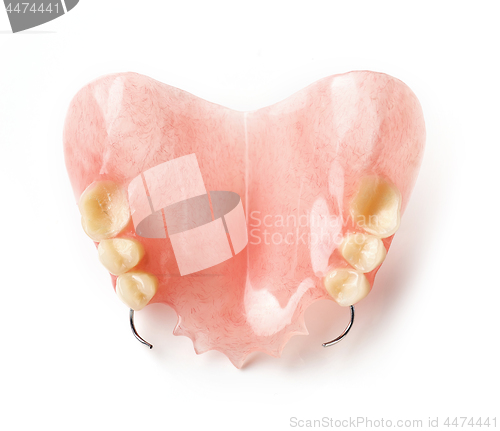 Image of partial removable denture