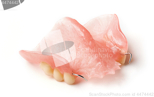 Image of partial removable denture