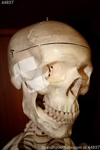 Image of Human scull