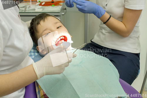 Image of Orthodontist examining boy mouth