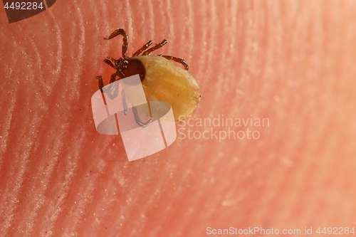 Image of Tick on skin