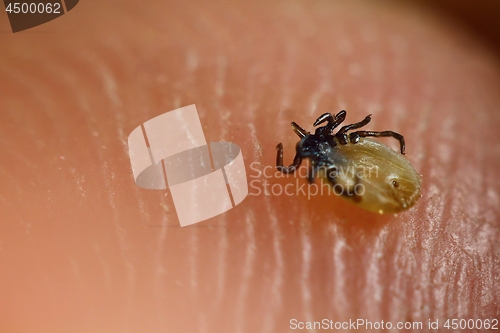 Image of Tick on skin