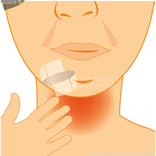 Image of Vector illustration of the person with sick throat