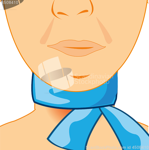 Image of Sick throat of the person enfolded in warm scarf