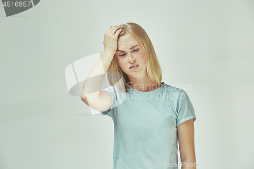 Image of Woman having headache. Isolated over pastel background.