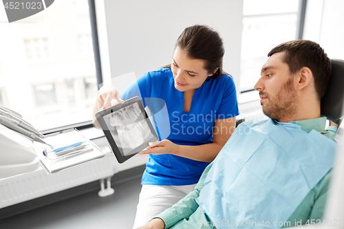 Image of dentist showing panoramic dental x-ray to patient