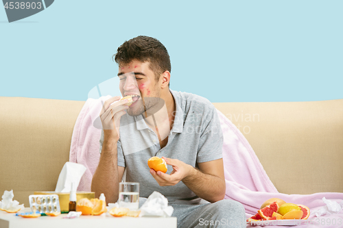 Image of Young man suffering from allergy to citrus fruits