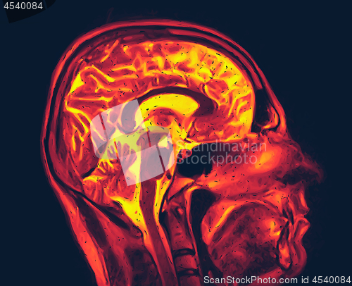 Image of Magnetic resonance imaging of the brain. MRI scan vector