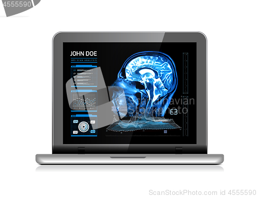 Image of Notebook monitor with medical MRI and other real-time analyzes. Medicine of the future. Vector illustration on white