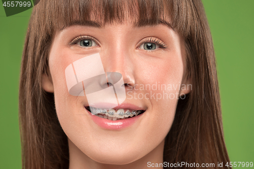 Image of Beautiful young woman with teeth braces