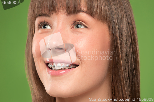 Image of Beautiful young woman with teeth braces