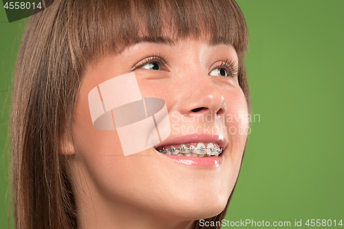 Image of Beautiful young woman with teeth braces