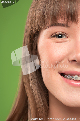 Image of Beautiful young woman with teeth braces