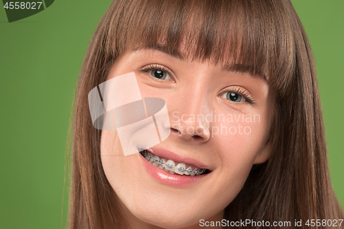 Image of Beautiful young woman with teeth braces