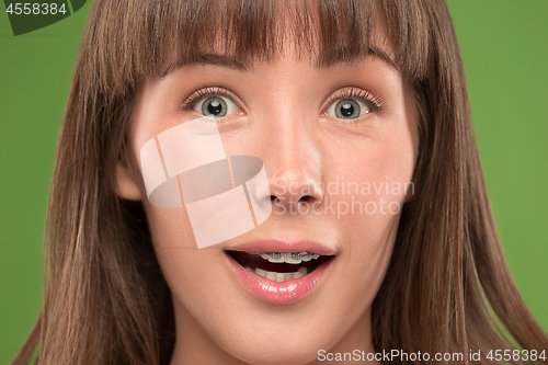 Image of Beautiful young woman with teeth braces
