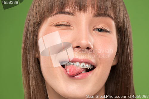 Image of Beautiful young woman with teeth braces