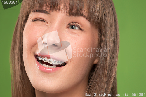 Image of Beautiful young woman with teeth braces