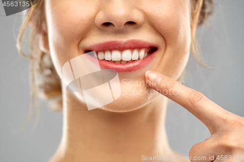 Image of close up of woman pointing to her white teeth