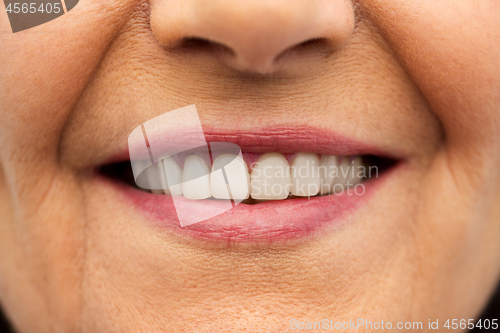 Image of close up of senior woman smiling mouth and teeth