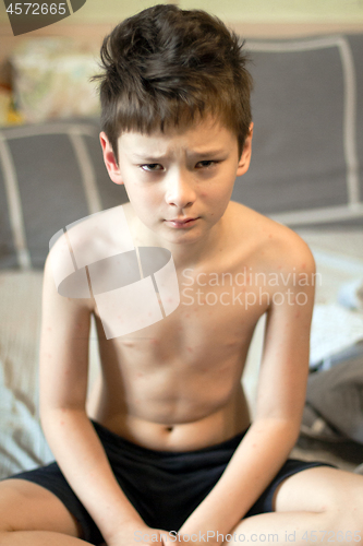 Image of Boy with chickenpox