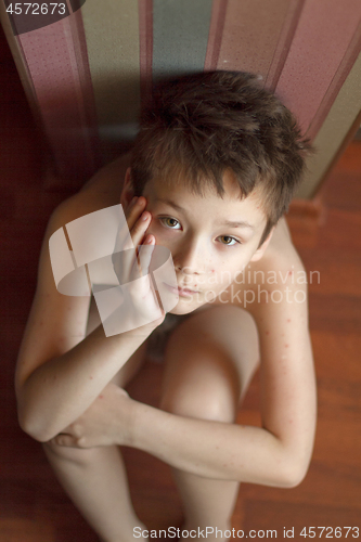 Image of Boy with chickenpox